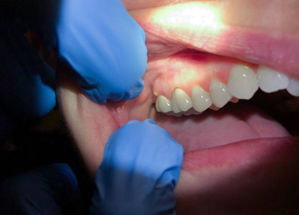 Best Tooth Infection Emergency Dentist  in Clifton, NJ